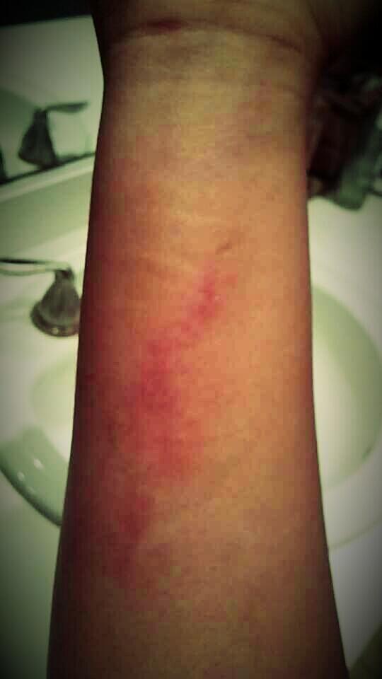 _Kaathyddd's tweet image. The fat doesn't want to die without a fight💪😂#HikingProblems#BeastMode#WarriorMarks via #Camera360#