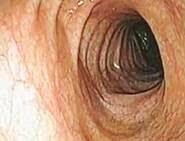 Penampang usus yg sehat.. Bersih... #UsusSehat