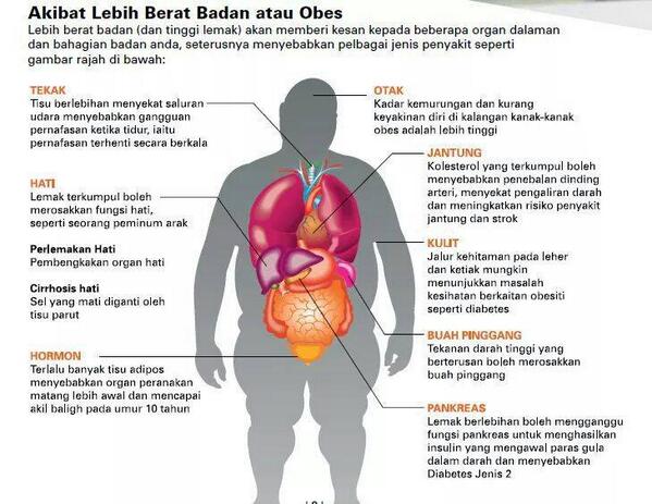 10 Kesan Obesiti Kepada Tubuh Manusia