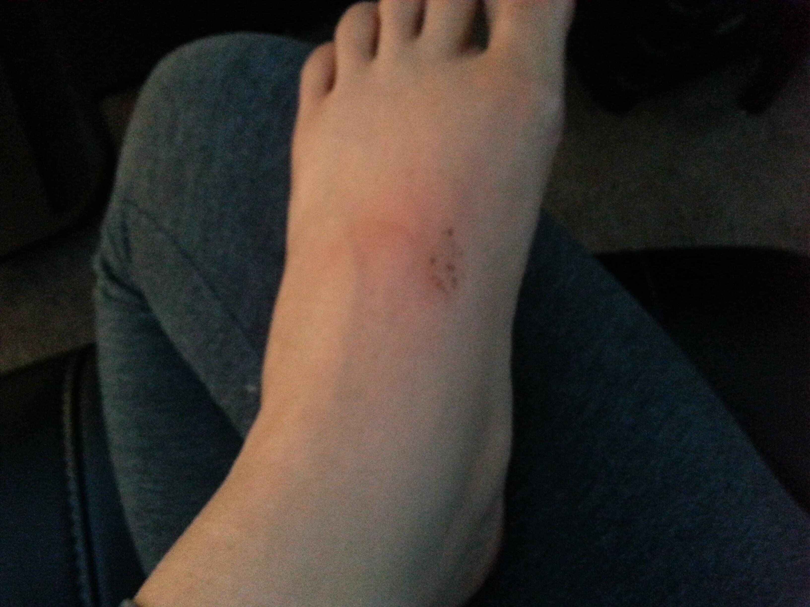 Foot Streaming Android Alinity on Twitter: "Hurt my foot while streaming :(  http://t.co/cOaJ7tjj9W" / Twitter