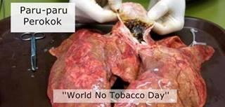 sahreny's tweet photo. Happy World No Tobacco Day. Stop smoking now, always love your self and keep your health ☺ http://t.co/Ursd8le62G