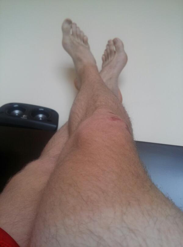 Mattyicetri's tweet photo. Chillin with the legs up. Need a good race to get a bit of a mental boost! http://t.co/iLaIbuwJkn