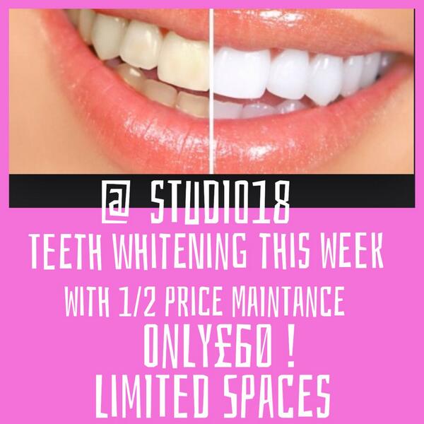 Studio18lisburn tweet picture