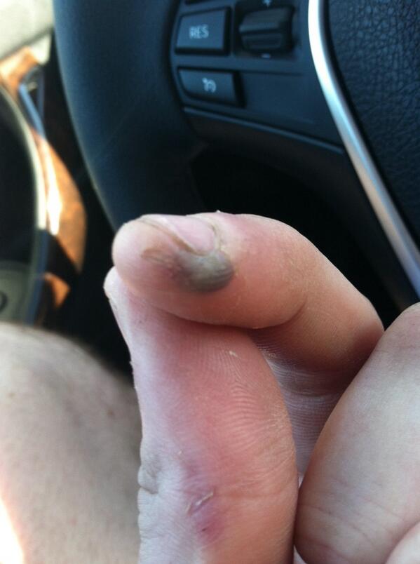 SkitzzzR6's tweet image. #PitcherProblems