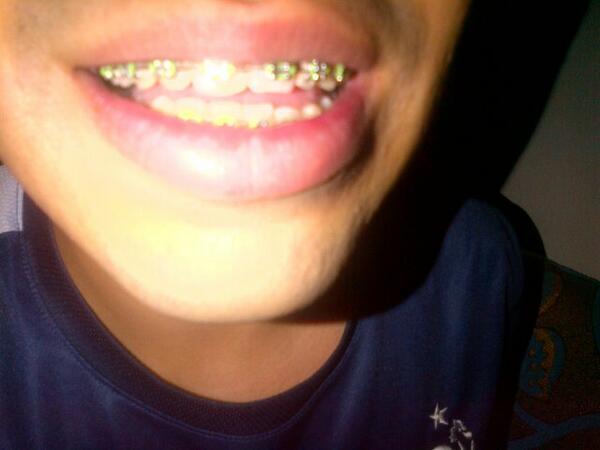 من ودوه يمص شفتي