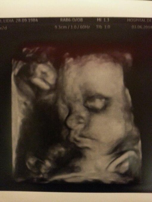 Me han exo una eco 3D en el hospital de mi Zoe tiene mi nariz y mis ojoooos! !! Es preciosa :))) http://t