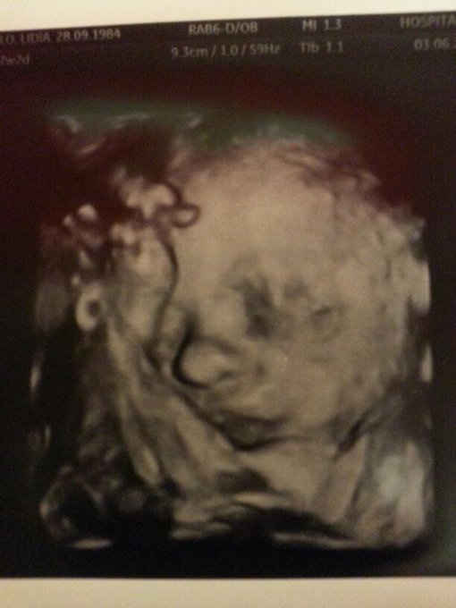 Me han exo una eco 3D en el hospital de mi Zoe tiene mi nariz y mis ojoooos! !! Es preciosa :))) http://t