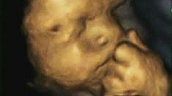 A3Noticias's tweet photo. Descubren la cara del feto cuando detecta que su madre está estresada http://t.co/4XJu4BXkLW http://t.co/CgbKoqpzPI