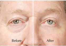 NuLiftAd's tweet photo. Remove #Face #Wrinkles in #Minutes @ http://t.co/O5m4b91X4z
#skincare #sexyfoods #vacation #feelings #feelingawesome http://t.co/BvsaNeaI7n