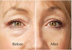 NuLiftAd's tweet photo. Remove #Face #Wrinkles in #Minutes @ http://t.co/O5m4b91X4z
#skincare #sexyfoods #vacation #feelings #feelingawesome http://t.co/BvsaNeaI7n