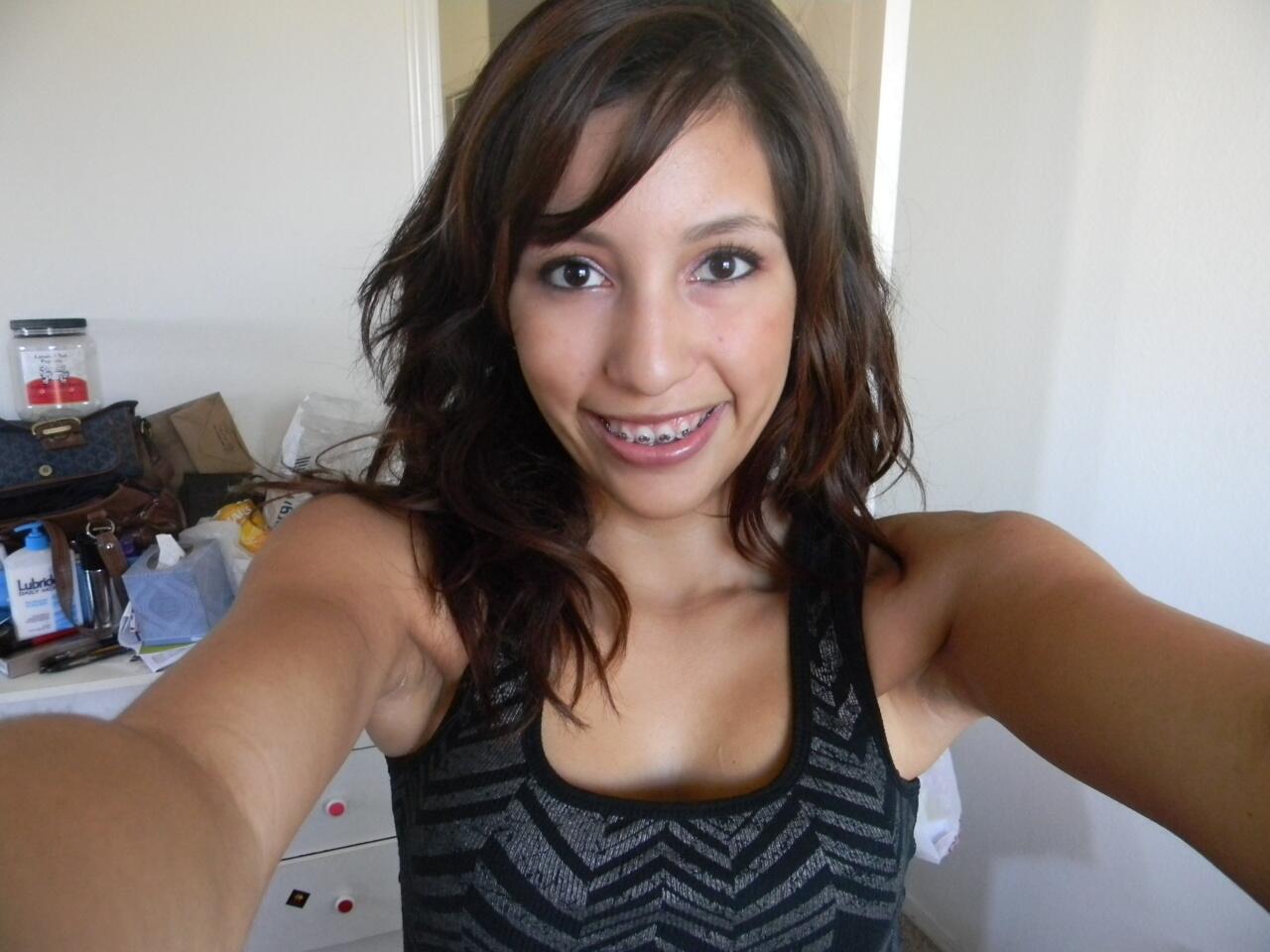 Girls With Braces on Twitter "Doesn't It Look Like She Wants A Hug? 