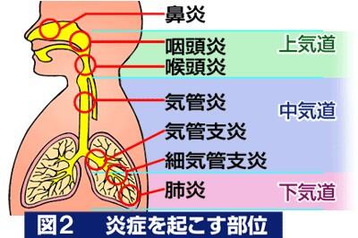 توییتر ゴロ 解剖生理イラスト در توییتر 呼吸器系の炎症を起こす部位 T Co Ggsjoovmuj