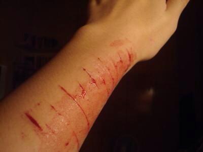 cancerdelrey's tweet photo. #CutForZouis #CutForBieber I'm just so hurt.. http://t.co/EycVDkWfkO