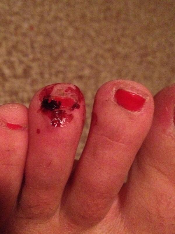 emilybiedenfeld's tweet image. Thanks a lot, @ericfeldman9 for this. #throbbing #worthit #dancingfools