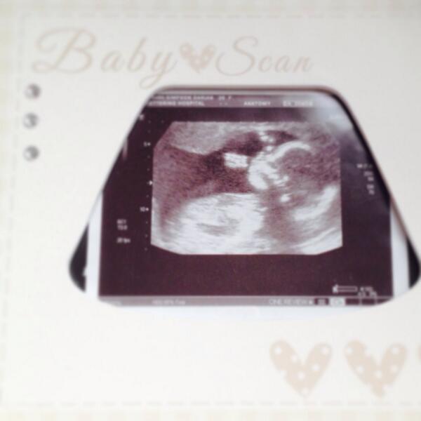 dariaanx's tweet photo. my little man 💙 http://t.co/epYbCCh2m9