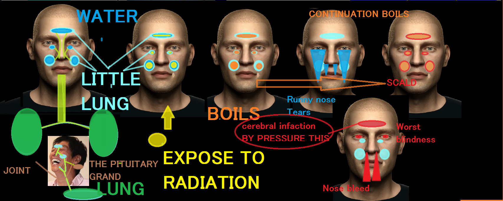 R L R Earth Fukushima Expose Radiation 花粉症 鼻血 涙腺異常 被曝 Cerebralinfarction Sameshows 21gene3 Downsymdrome Http T Co 4tc72wavoz Twitter
