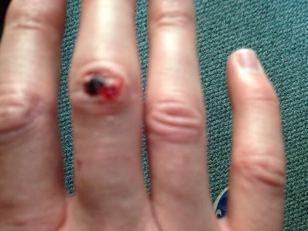 If my knuckles aren't bloody, I didn't play my hardest. #tennisbattle