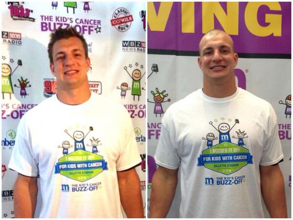 RobGronkowski's tweet photo. I'm tackling pediatric cancer today with @buzzforkids! Before &amp; after! What do you think? #buzzforkids http://t.co/hsJyJqtlWQ