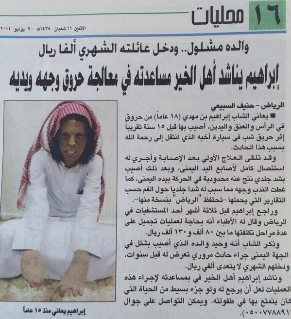 New_M3lomat's tweet photo. #إبراهيم_يناشدكم معالجة حروق وجهه ويده، والده مشلول ودخل أسرته الشهري ألف ريال فقط! - للتواصل: 0500778891

#انشروها
- http://t.co/AyA7jh2nXR