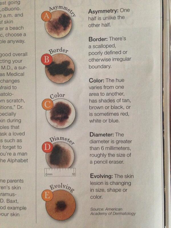 MorganDerm's tweet image. Know the signs! Save your skin! Book an appointment today for your skin check!