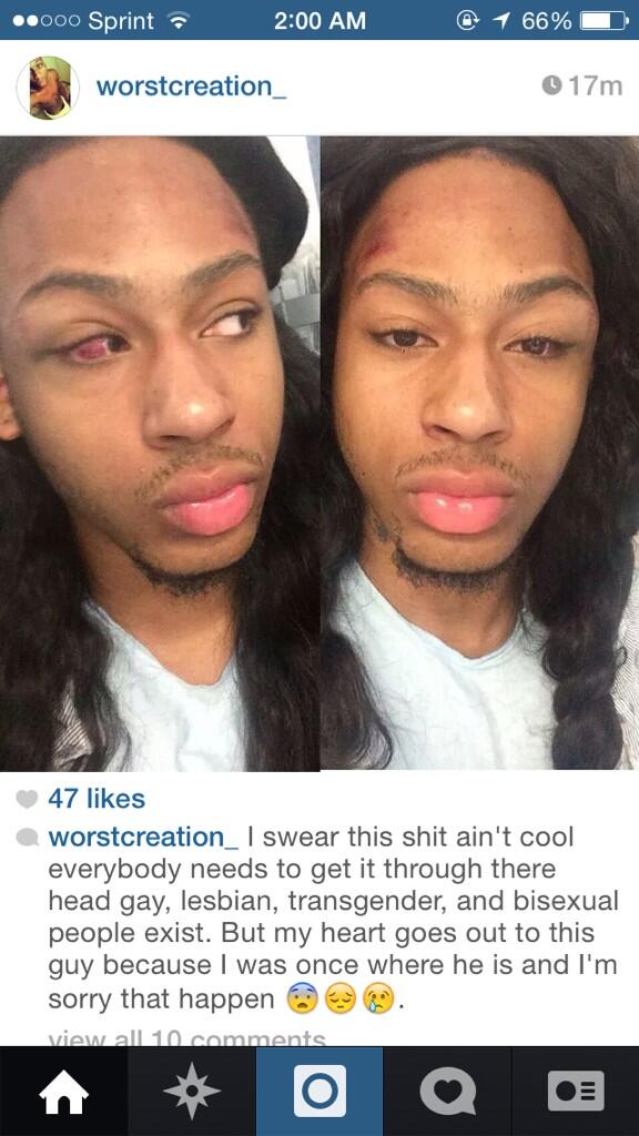 PrettyBoyLife__'s tweet image. This shit getting outta hand bruh. Frfr. I wish a mf WOULD try me. 👊😡🔫🔪💣🚬💉 #TryMeNot