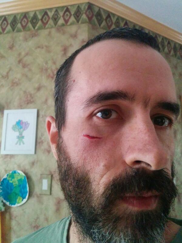 brettmiller's tweet photo. Clash between my face and my 4 year olds chin. The chin won. http://t.co/2cCetaStVP