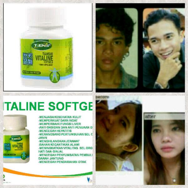MaskerAlami_ID's tweet photo. Mau Punya Kulit Putih? Bebas Flek dan Jerawat? Ready Pemutih Herbal. Invite Pin: 27ae580a , Hp 082217608421 #TERBUKTI http://t.co/ZLJLTckRi7