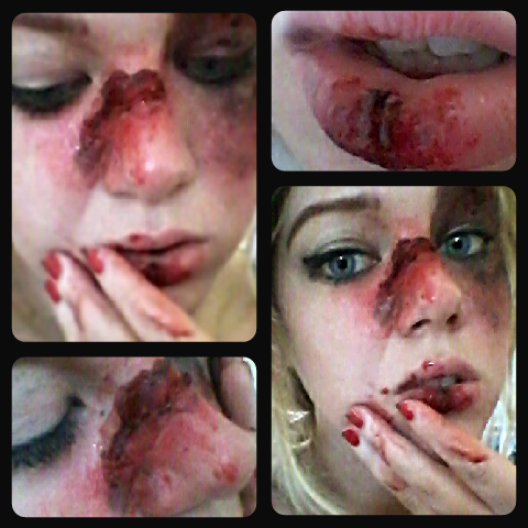 jadeholt1's tweet image. Sfx work #makeupartist #portfolio #theatrework