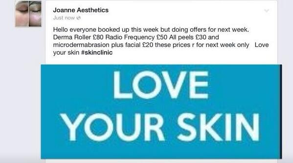 radiofrequency3's tweet photo. These offers apply to this week only 😷😎 http://t.co/II4vuXIWFO