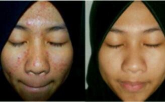 Check pict! ini msalah km jg?kmi beri solusinya..info/order hub.pin 2257DDFE/081317537994