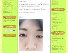 itsuki_chi's tweet photo. 【画像】 声���・林沙織 「自殺に失敗してこんな顔になりました…もう声優はできません」

　→http://t.co/4k6XarWRed

. http://t.co/HhTi5Fsix3