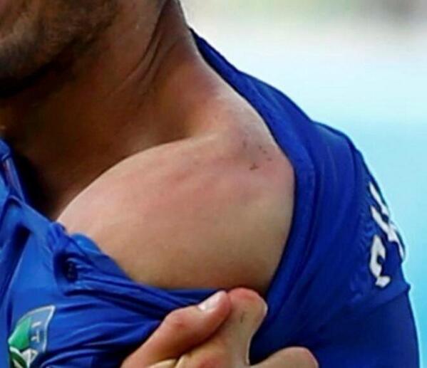 Quel vicieux ce Chiellini, il a réussi à donner un coup d'épaule aux dents de Suarez! #itauru