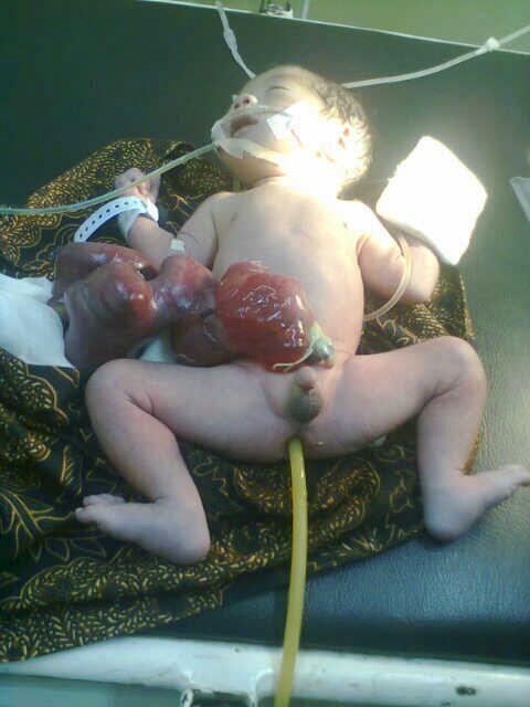 yeyen nurlia tweet media