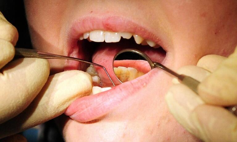 Tooth repair drug' may replace fillings - BBC News