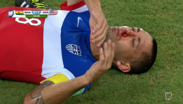 BroBible's tweet photo. The next time someone calls soccer a "pussy sport," show them Clint Dempsey's nose. http://t.co/KNKQa2EKz9