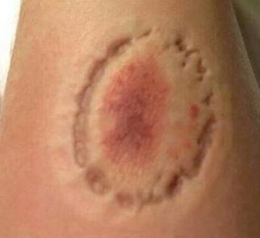 NOT_MOTD's tweet image. Asked Suarez for an autograph..