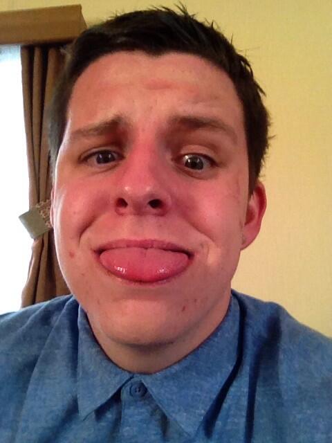 jasemcon's tweet photo. Burnt face🔥 http://t.co/Qo4auEvaih