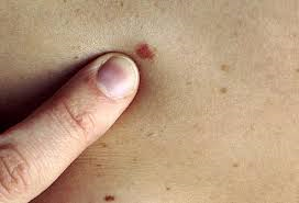 RazoriteHealth tweet picture