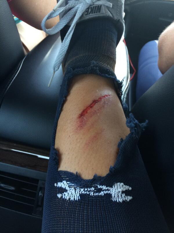 cool scar coming soon