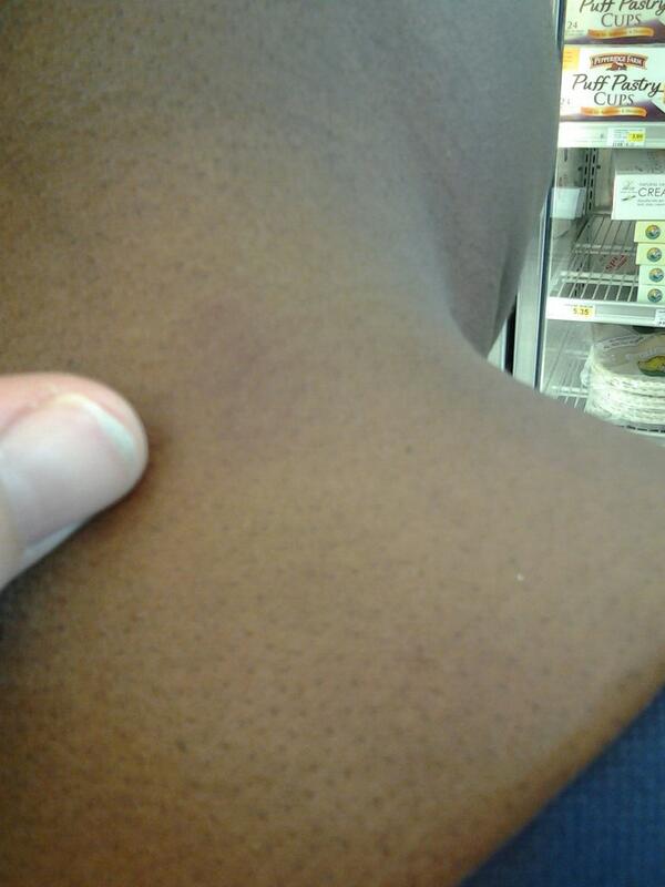 ReallyBored41's tweet photo. @cuntlickerz666 oh yes, I left this suck mark on the back of your neck when I came hard in your juicy pussy. http://t.co/cDJEXrGFSe