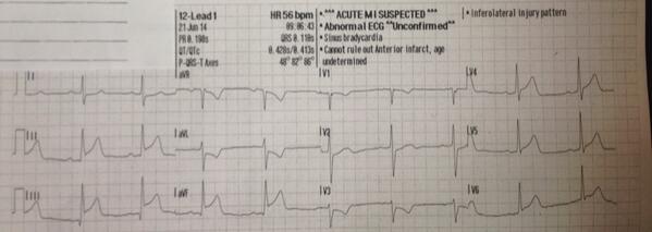 tbouthillet's tweet image. MT @Medic_120: When prehospital care is at its best #CodeSTEMI