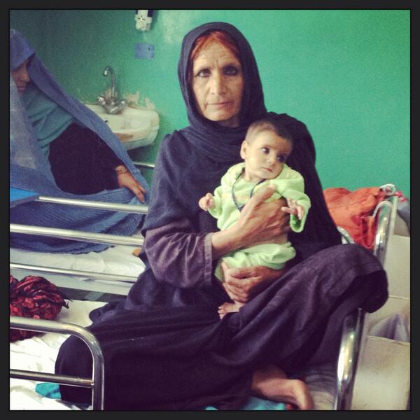 Zarmina, admitted this morning in #MSF malnutrition program.Such cases increase in the summer #Helmand #Afghanistan