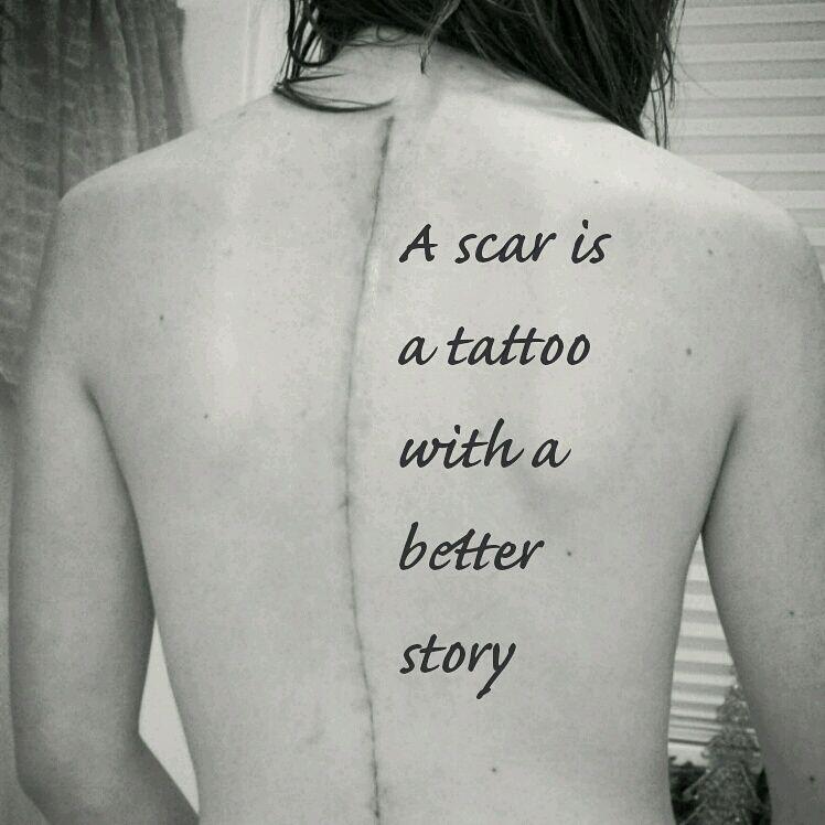 55 Incredible Scar Tattoo Cover Ups  Inspirationfeed
