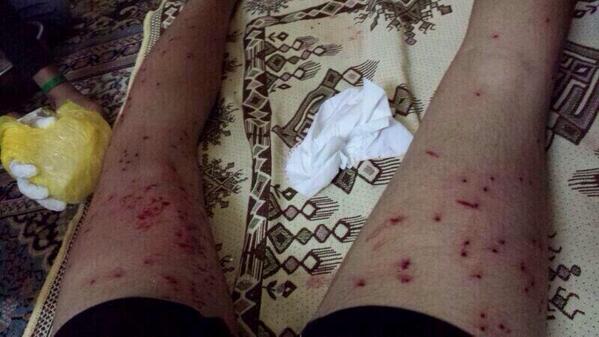 Alwillaya's tweet image. #منصور_الجمري يقول تفجير #العكر يعكّر أجواء شهر رمضان ،، على أساس ما يفعله النظام يفتح النفس و يهيئ الأجواء #البحرين