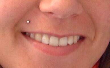 NOGOODQ's tweet image. YOU KNOW SHE A HOE WHEN SHE GOT THIS PIERCING