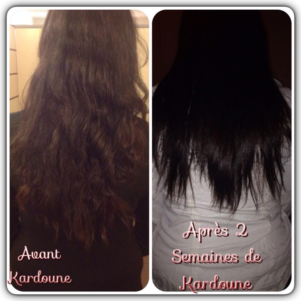 kardoune avant après