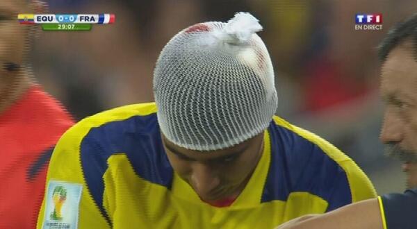Willy_Rovelli's tweet photo. Bon bah au moins pour le moment ce match aura eu une belle action: nous rappeler qu'il faut sortir couvert. #FRAEQU http://t.co/UJDtWI6c9d