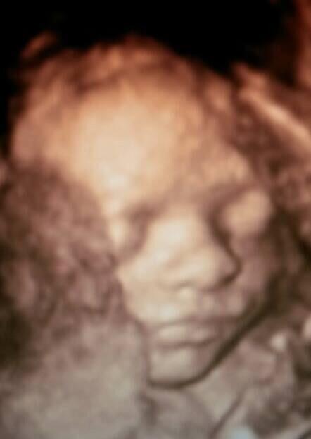 Pearl_baby_scan's tweet image. Gorgeous bubbas this evening #3dbabyscan #pregnancy 💙💗