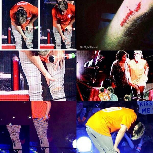 givehoranhugs's tweet photo. HE DIDNT DESERVE THIS.

AND IM NOT OKAY 

#FeelBetterNiall 
#Just1DFandomFollowParty http://t.co/IfAO9ACVdv