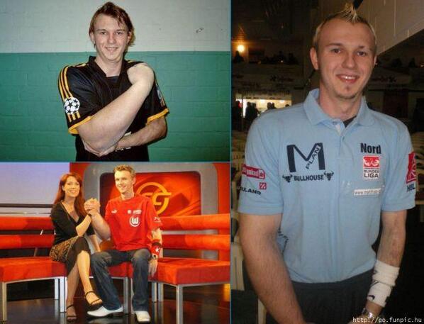 Know's tweet image. There's actually a German arm wrestling champion with a right arm that is about 33% larger than his left.